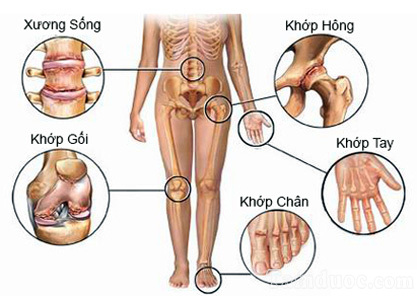 cách chữa đau cơ, đau khớp lưng, cổ, vai, tay, chân