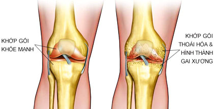 công dụng của glucosamine